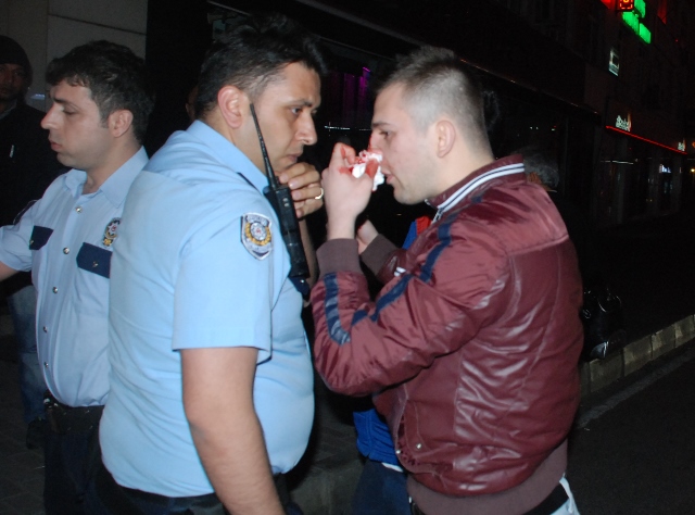 Sokak Eşkiyaları Polisin Burnunu Kırdılar